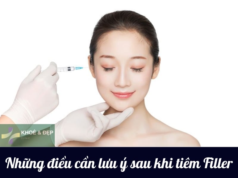 Những điều lưu ý sau khi tiêm filler