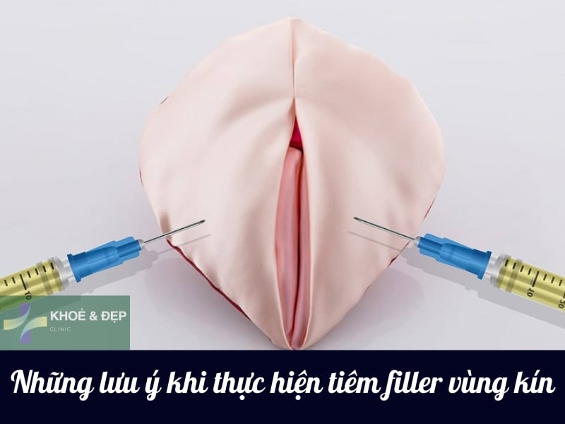 Những lưu ý khi tiêm filler vùng kín