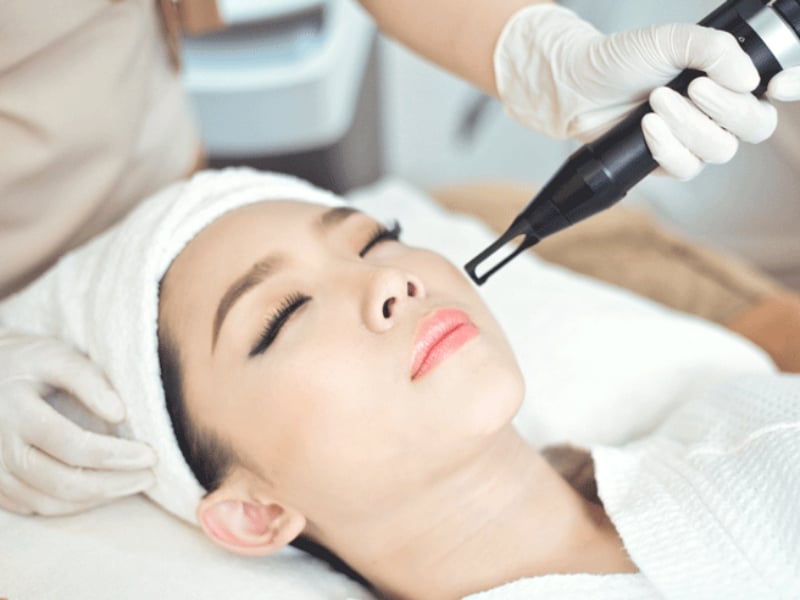 Những ưu điểm khi sử dụng laser