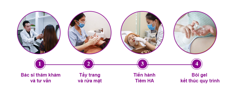 Quy trình tiêm HA vùng mắt theo tiêu chuẩn y khoa