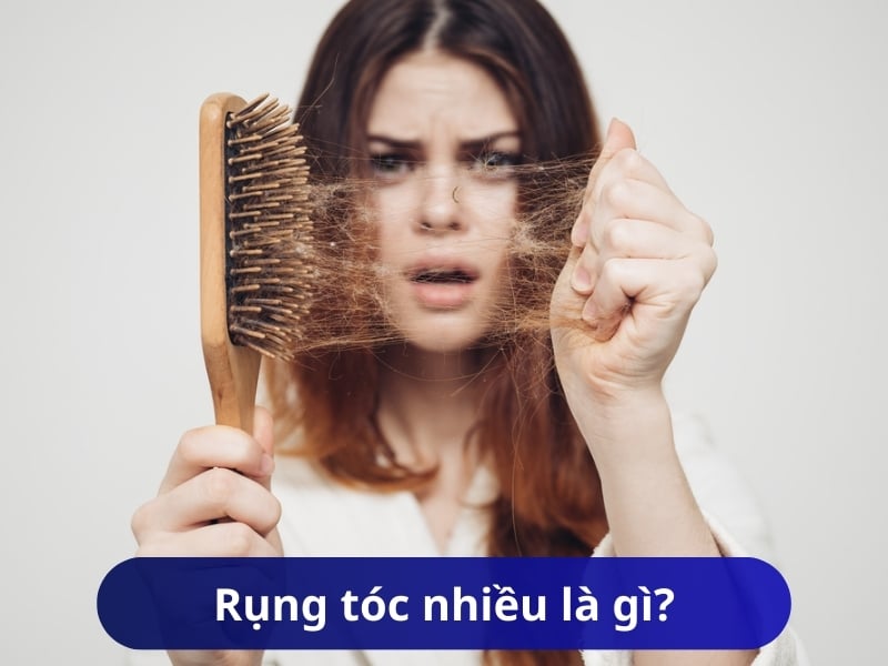 Rụng tóc nhiều là gì?