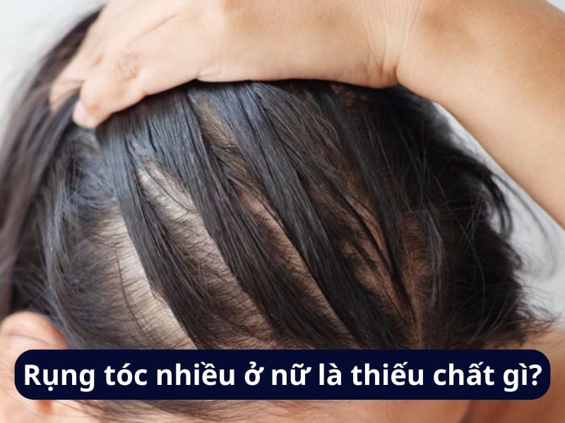 Biện pháp ngăn ngừa tình trạng rụng tóc ở nữ giới