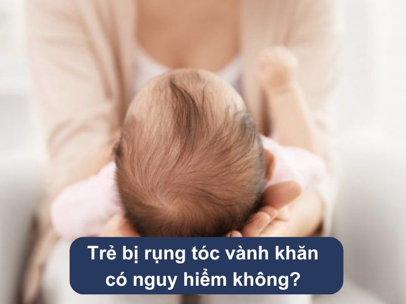 Trẻ bị rụng tóc vành khăn có nguy hiểm không?