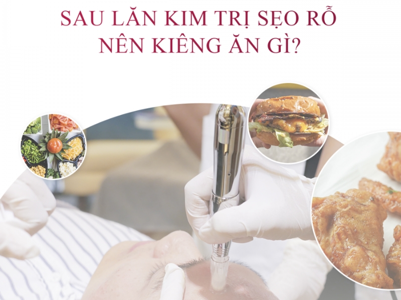 Sau khi lăn kim trị sẹo nên kiêng gì?