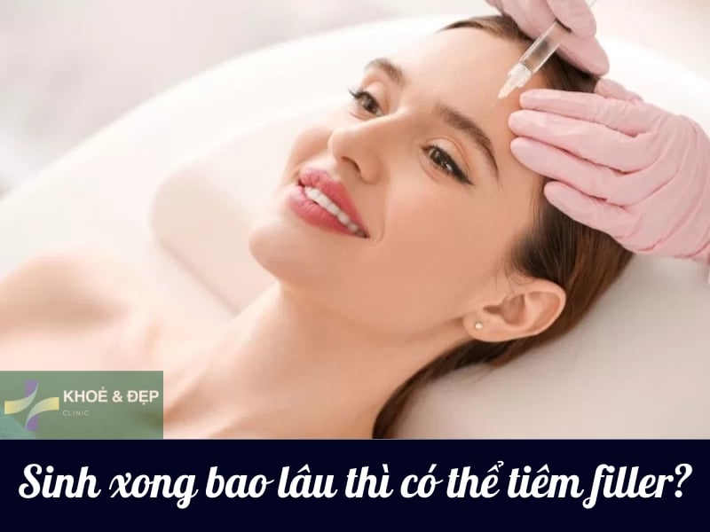 Sinh con xong sau bao lâu thì có thể tiêm filler?
