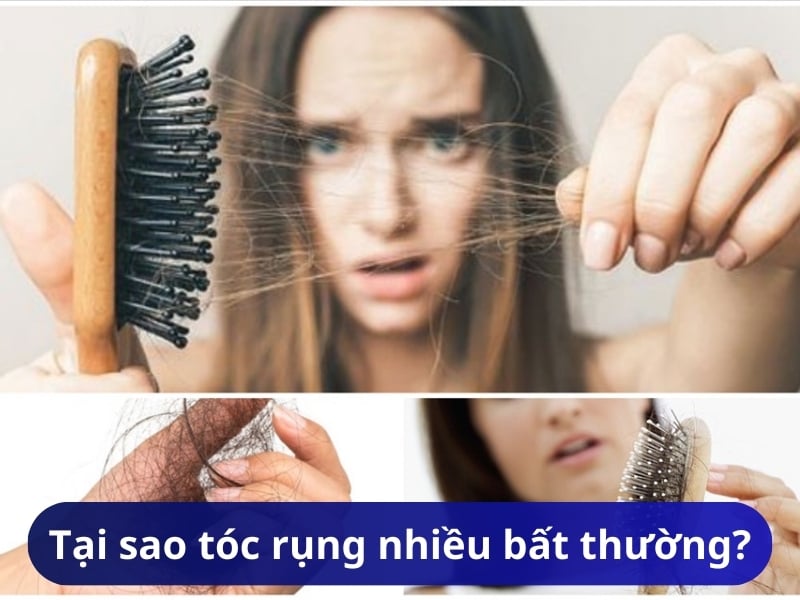 Tại sao tóc rụng nhiều bất thường?