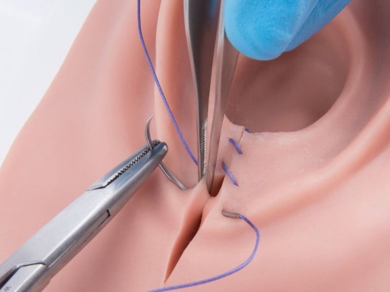 Tân trang cô bé là gì?