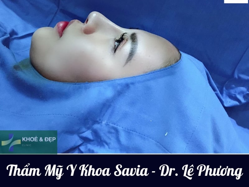 Thẩm Mỹ Y Khoa Savia – Dr. Lê Phương