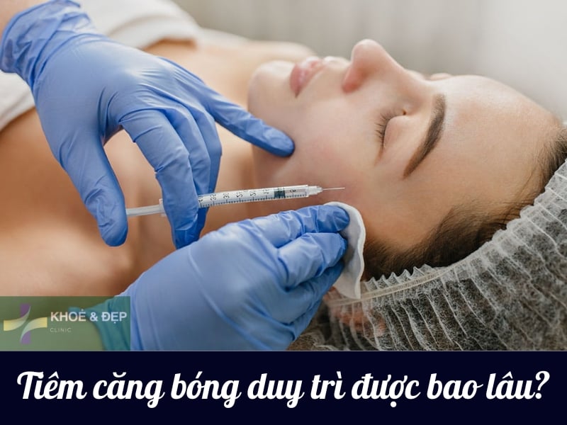 Tiêm căng bóng duy trì được bao lâu?