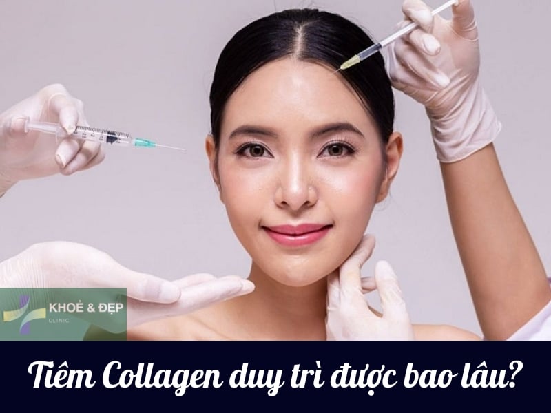 Tiêm collagen sau bao lâu cần tiêm lại?