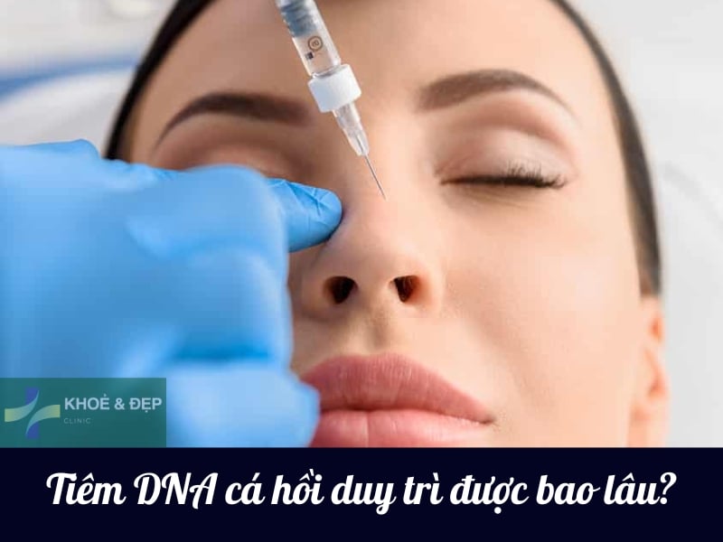 Tiêm DNA cá hồi duy trì được bao lâu?