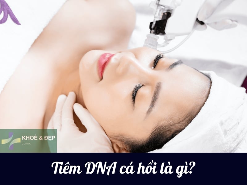 Phương pháp tiêm DNA cá hồi là gì?