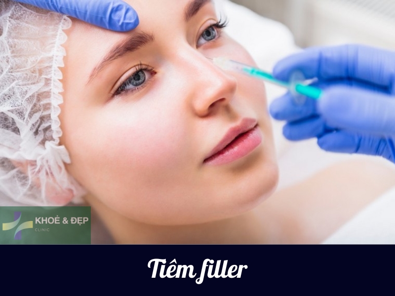 Tiêm filler