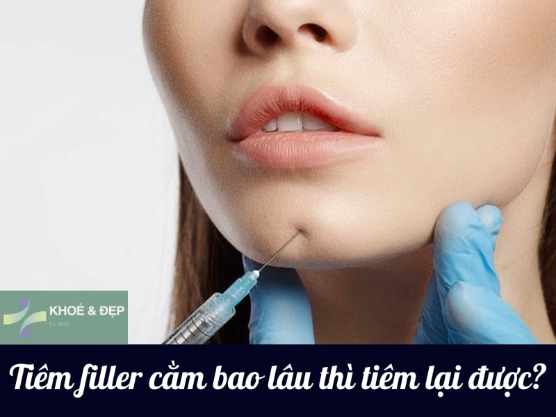 Tiêm filler cằm khi nào thì tiêm lại được?