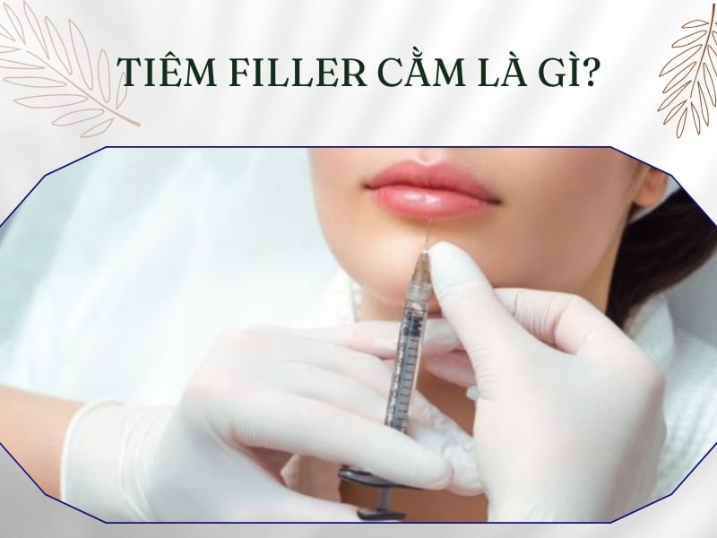 Tiêm filler cằm là gì?