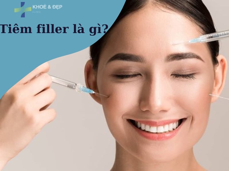 Phương pháp tiêm filler là gì?