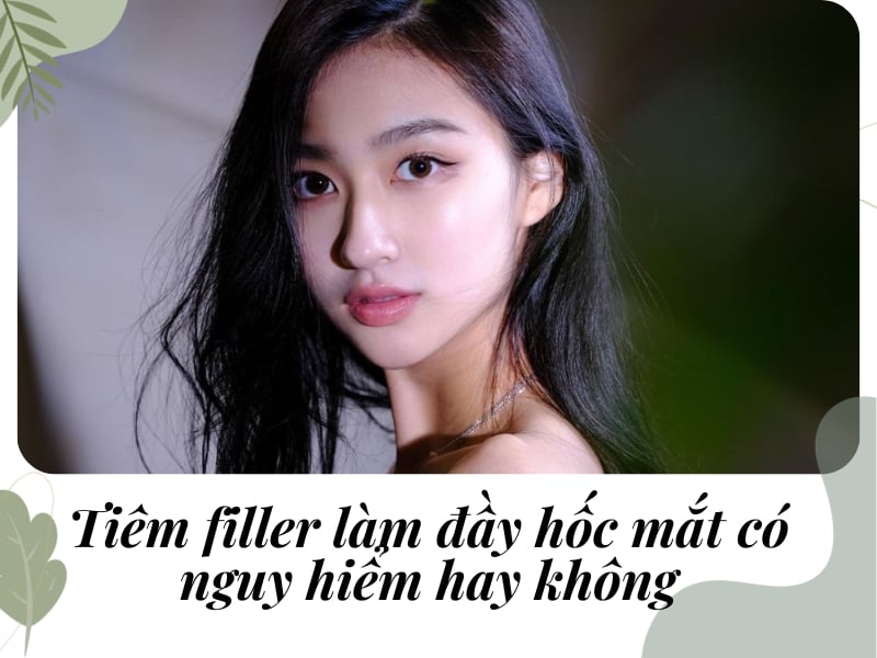 Tiêm filler làm đầy hốc mắt có nguy hiểm hay không?