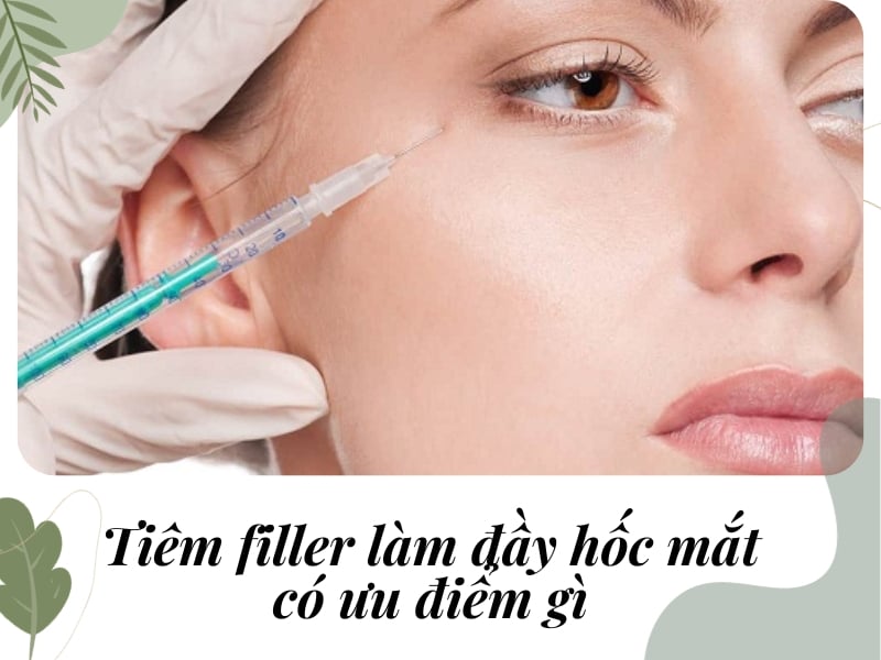 Tiêm filler làm đầy hốc mắt có ưu điểm gì?