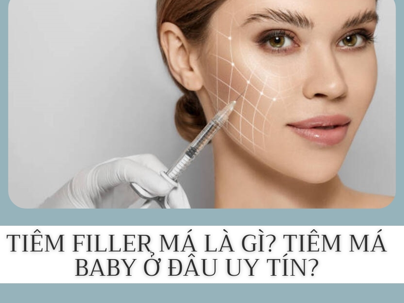 Tiêm má baby là gì?