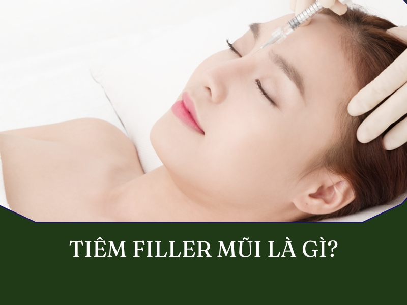 Tiêm filler mũi là gì?