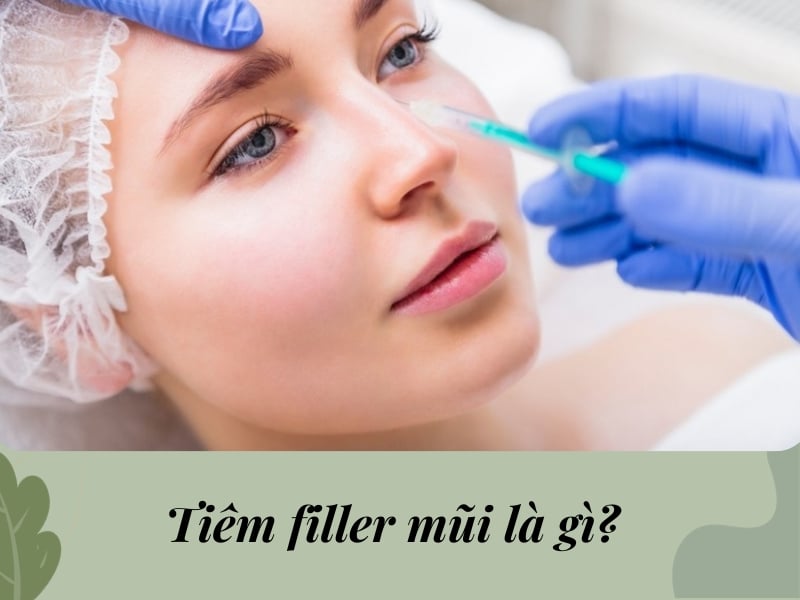 Tiêm filler mũi là gì?