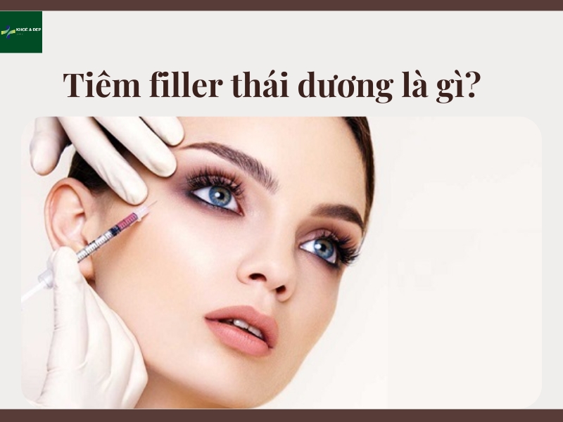 Tiêm filler thái dương là gì?