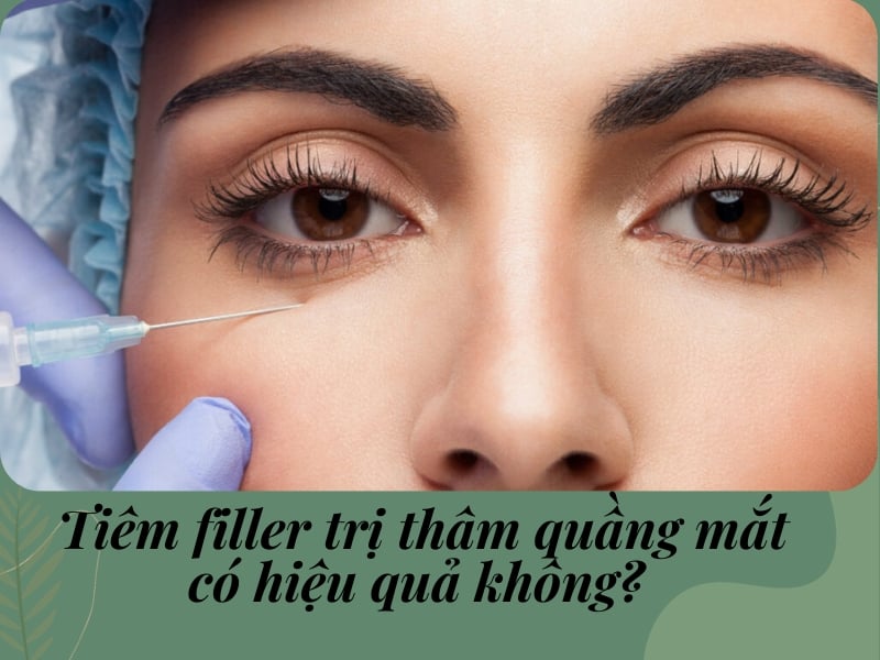 Tiêm thâm quầng mắt có hiệu quả không?