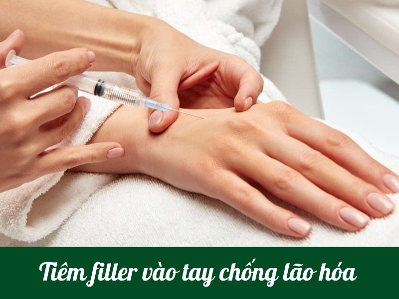 Tiêm filler chống lão hóa da tay