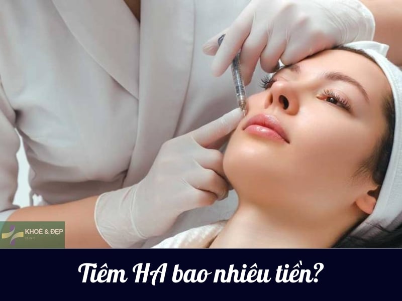 Tiêm HA bao nhiêu tiền? Chi phí tiêm HA là bao nhiêu?