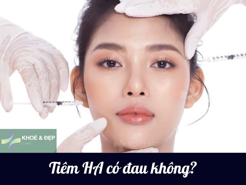 Tiêm HA có đau không?