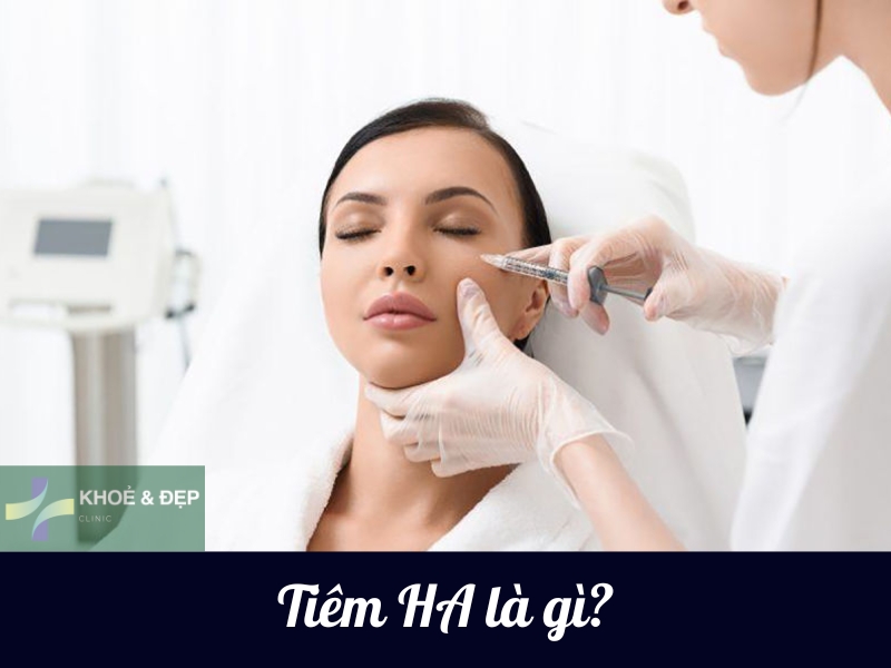 Phương pháp tiêm Hyaluronic Acid (HA) là gì?