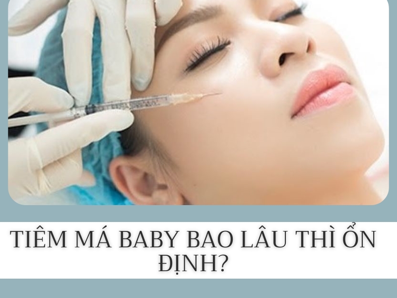 Tiêm má baby là gì?