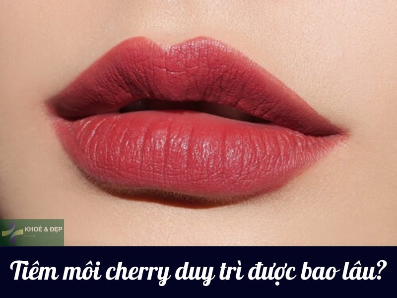 Tiêm môi cherry giữ được bao lâu?