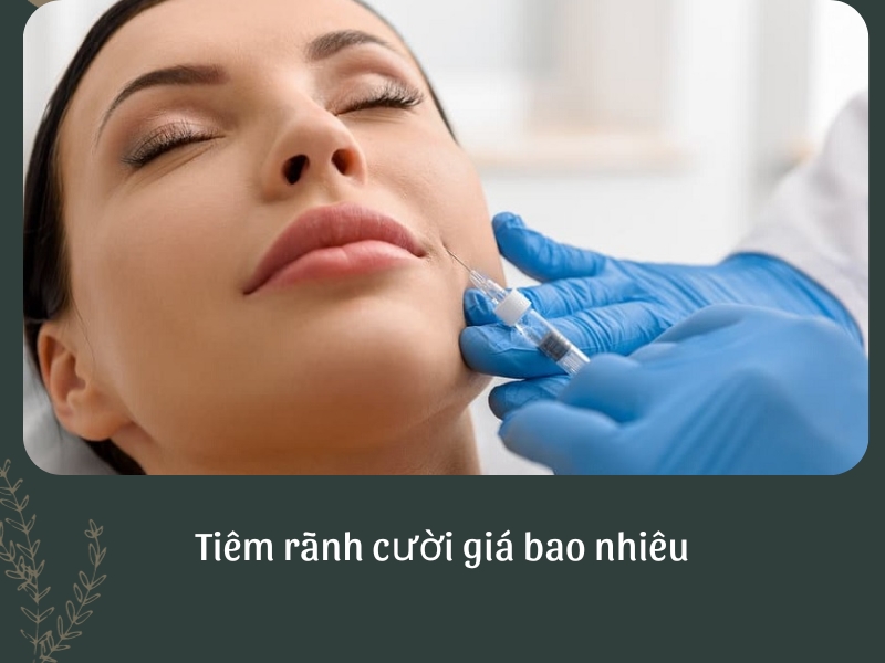 Tiêm rãnh cười giá bao nhiêu?
