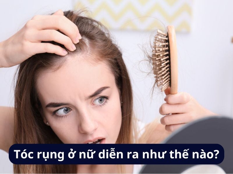 Tóc rụng ở nữ diễn ra như thế nào?