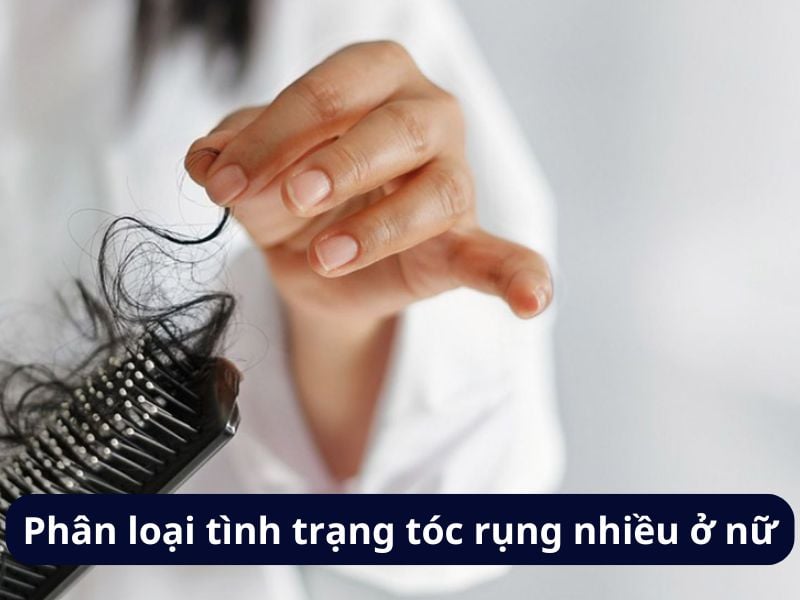 Phân loại tình trạng tóc rụng nhiều ở phụ nữ/con gái