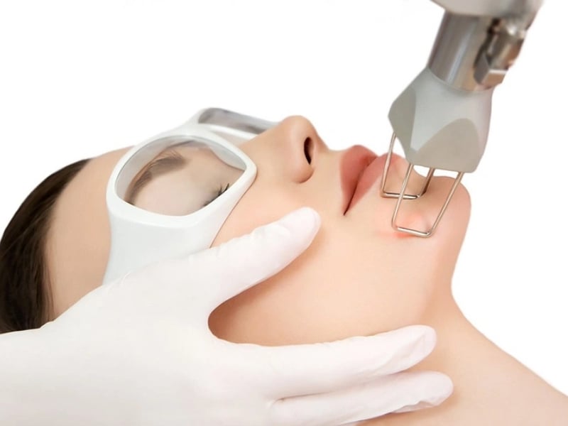 Trị sẹo trắng bằng biện pháp y khoa