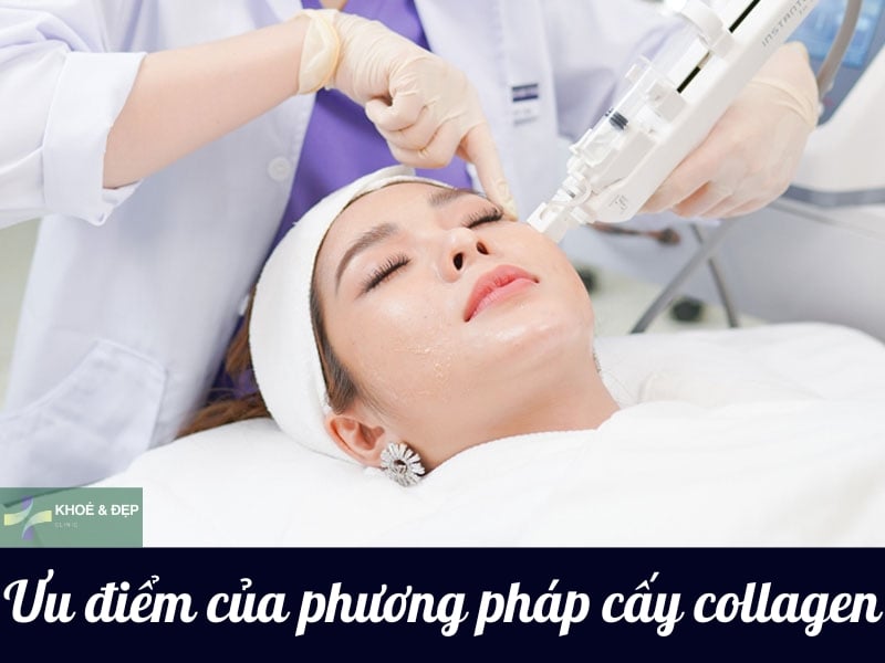 Lợi ích của liệu pháp tiêm collagen