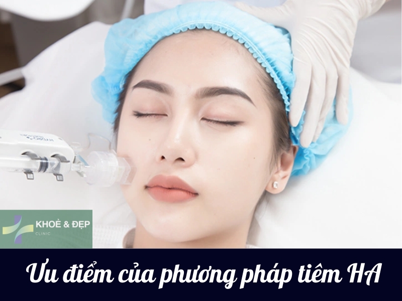 Các lợi ích của việc tiêm HA