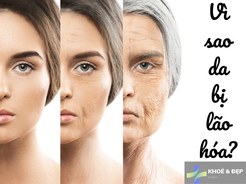 Vì sao da bị lão hóa?