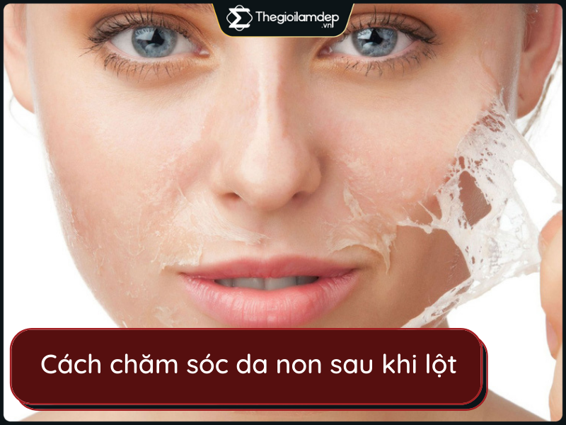 Cách chăm sóc da non sau khi lột an toàn, hiệu quả nhất