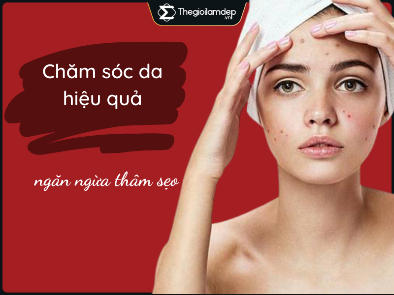 Các sản phẩm chăm sóc da mụn hiệu quả, ngăn ngừa thâm sẹo