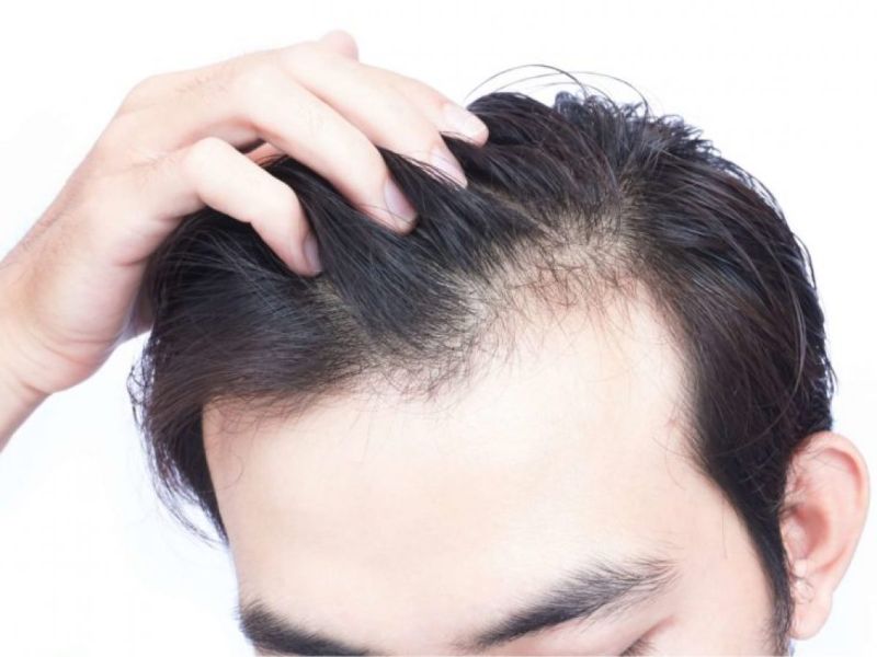 9 cách kích thích mọc tóc bằng phương pháp tự nhiên hiệu quả