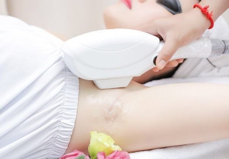 Top 10 spa triệt lông Đà Lạt – Lâm Đồng uy tín