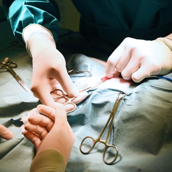 Cắt hạch mồ hôi giao cảm phương pháp tốt hay rủi ro?