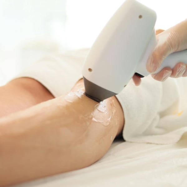 Điều Trị Mồ Hôi Nách Bằng Laser: Xâm Lấn Tối Thiểu Nhưng Cần Cẩn Trọng