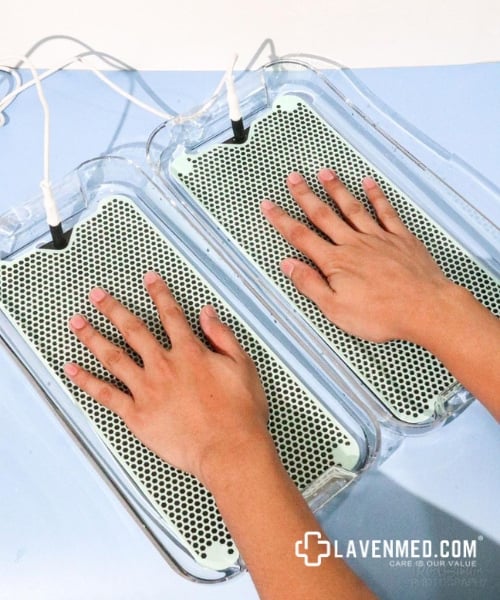 Điều Trị Mồ Hôi Tay Chân Hiệu Quả Bằng Máy Điện Di Ion – Giải Pháp Không Xâm Lấn Được Khuyên Dùng