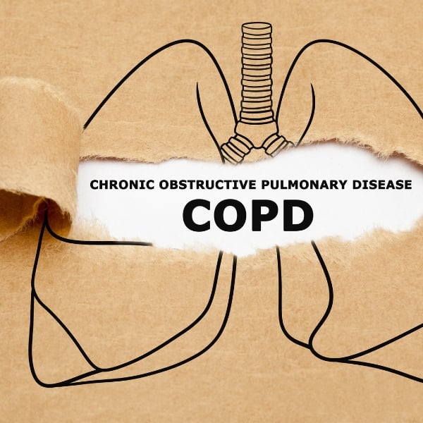 Tế Bào Gốc Trong Điều Trị COPD: Giải Pháp Tiên Tiến Cho Bệnh Phổi Tắc Nghẽn Mãn Tính