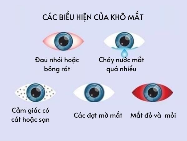 Các triệu chứng chính của bệnh khô mắt