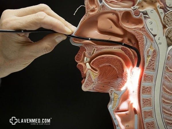 Bệnh nhân tuyệt đối tuân thủ yêu cầu của bác sĩ trước khi phẫu thuật cắt thanh quản